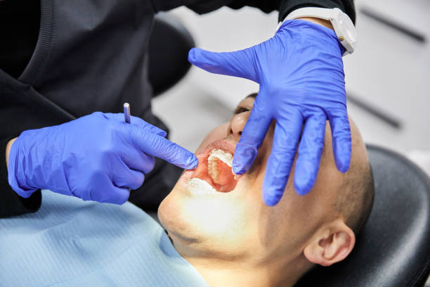 Best Emergency Dental Care for Abscessed Tooth in Franklin, NH